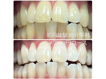 ホワイトニングルーム 横浜店(Whitening Room)/セルフホワイトニング/横浜