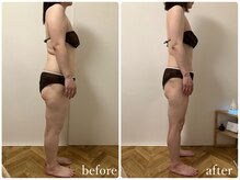 リリィブラン(Lily branc)/痩身/ダイエット