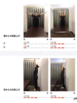 女性専用整体サロン　ベル 岩国店/ 【50代】姿勢Before After