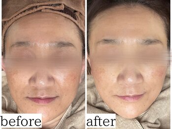 アンドナップ(nap)/スキンケアフェイシャルワックス