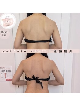 アンテイン チル(anthein chill)/温熱痩身