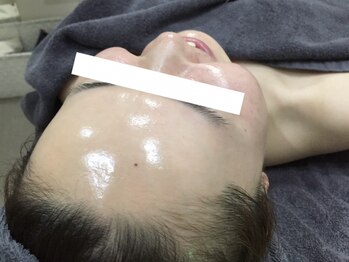 ハダハダ(HADA HADA Medical Esthetic)の写真/当店の顔脱毛は【★韓国★美肌脱毛★】《顔脱毛＋角質ケア》でちゅるちゅるピカピカたまご肌へ♪体験2000円