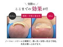 ネイルラボ 水天宮中央院(naillab.)の雰囲気（落ち着いた空間で施術◎巻爪,陥入爪,深爪,割れ爪なら当店へ!）