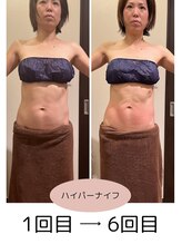 若松整体院 太白区院/ハイパーナイフ！