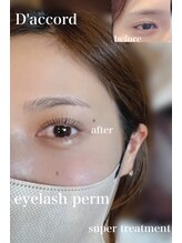 ダコード(D'accord)/上まつげパーマ