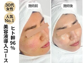 ディレイア ザ コスメ 有楽町マルイ店(direia the cosme)/ツヤ/赤み/くすみ[有楽町]