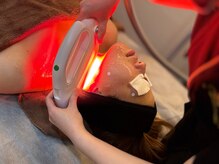 ユーセレクト ビューティー プラス(U-SELECT BEAUTY PLUS)/光フェイシャルでさらに自信UP！