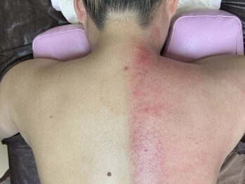 momoria郡山店の写真/【速攻効果◎】短期間で理想のボディへ!話題の新しい施術でサイズダウン♪オープン記念クーポン配布中!