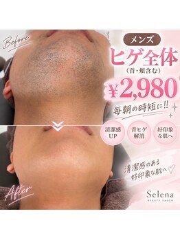 セレーナ(Selena)の写真/当店SHR脱毛は多くの方が苦手な「痛み」がIPLより少なくデリケートなお肌や部位も可能│ご好評