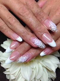 フレンチスカルプ