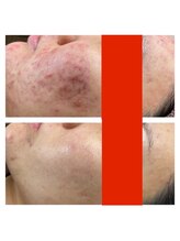 アム(Ame)/ビフォーアフターお写真