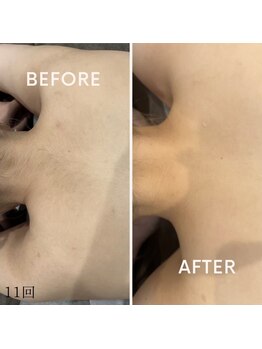 モアトゥインクル 東広島西条店(MORE twinkle)/見えない箇所も綺麗に