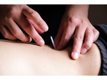 トリガー鍼灸 整骨院 五反田院/【鍼灸/整体/腰痛/マッサージ】