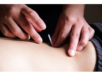 トリガー鍼灸 整骨院 五反田院/【鍼灸/整体/腰痛/マッサージ】