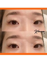 コヌン(Konun.)/LEDマツエク140本