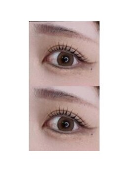 バニーアイズ 天神(Bunny eyes TENJIN)/トリートメントラッシュリフト