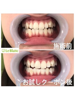 ルブラン 奈良店(Le Blanc)/黄ばみは不潔に見えます!