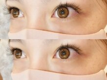 サッチモ(Satchmo)