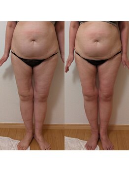 ヨサパーク アエル(YOSA PARK AELL)/１回で/よもぎ蒸し/痩身/肩こり