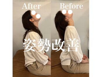 整骨院 整体院 ユールーム 周南支店(YOUROOM)