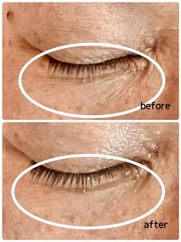 エステティックジュビラン アンビエンテ 福井南店/エイジングケア