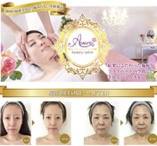 小顔矯正 アメリ ビューティーサロン(Ameri beauty salon)