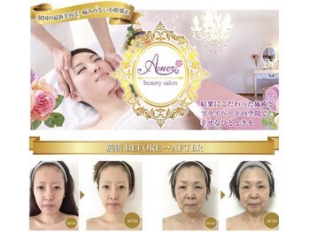 小顔矯正 アメリ ビューティーサロン(Ameri beauty salon)