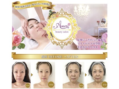 小顔矯正 アメリ ビューティーサロン(Ameri beauty salon)の写真