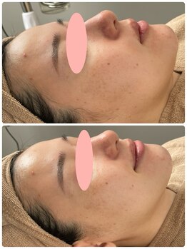 ロイ(Loy)/24/10/22のブログご覧ください♪