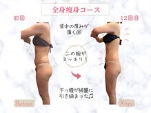 ビューティエン(beauty EN)の雰囲気（結果の出る痩身体験！）