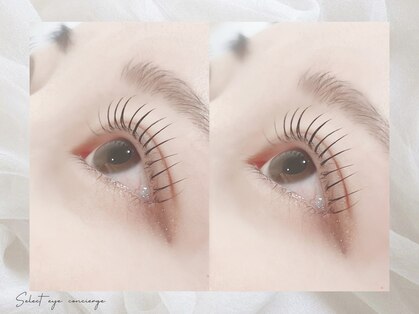 セレクト アイコンシェルジュ 新宿店(SELECT eye concierge)の写真