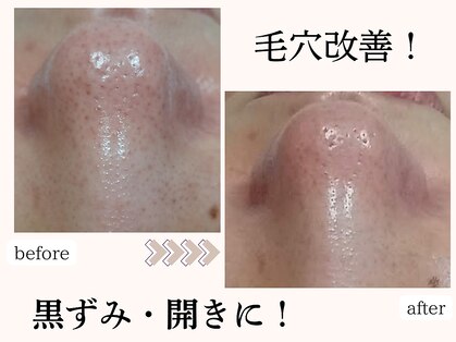 りりあすの写真