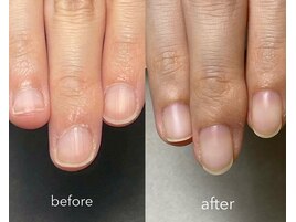 ビフォーアフター