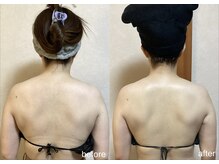 エスポワール(espoir)/小顔コルギ＋肩甲骨コルギ