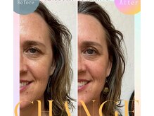 ミチ(MICHI)の雰囲気（アメリカでの実績。リフトアップと自立神経の調整も。）