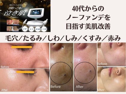 ルビー(RUBY)の写真