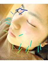 福田整体院/美容鍼 小顔・しみ改善