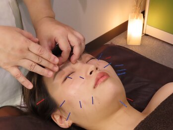 セイレイ(Sei-Rei)の写真/女性鍼灸師による痛みの少ない「優しい鍼」で施術◎【小顔×肌質改善】で短時間で理想のフェイスラインへ♪