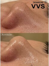 セレニテ(Serenite)/