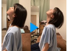 たすき鍼灸治療院/首コリ改善
