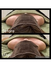 レインボー(Rainbow)/肩・デコルテケア