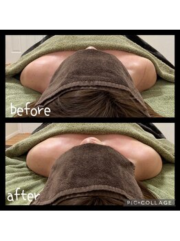 レインボー(Rainbow)/肩・デコルテケア