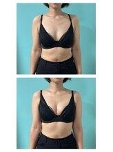 ネイト ワックス(Neit Wax)/下垂/ハリ・弾力/バストアップ