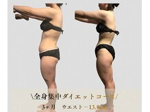 サンテボーテ(Sante Beaute)/お腹ペタンコ/肋骨薄く