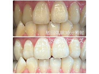 ホワイトニングルーム 横浜店(Whitening Room)/セルフホワイトニング/横浜