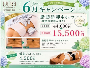 ウナ 西中島店(UNA)の写真/【夏前の本気痩せ】人気No.1！脂肪冷却4カップ(脂肪分解導入付き) で気になる脂肪を集中ケア