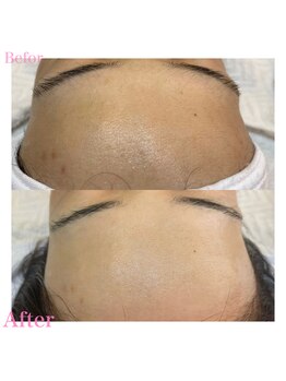 プリュスマイル(+Smile.)/フェイシャルワックス