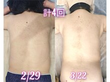 ナチュラルボディラボ 草津店/120分コース週1×4回