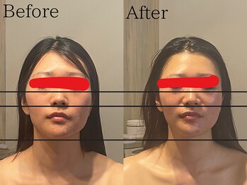 サロン ジジ(salon JiJi)/韓国小顔コルギ★