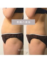 マニーク(MANIEQU)/悪魔の痩身